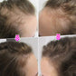 🔥ACQUISTA 1 E RICEVI 1 GRATIS💝Polvere di fibre volumizzanti per capelli