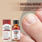 🔥Offerta natalizia a tempo limitato: 50% DI SCONTO!!!🔥Essenza riparatrice per unghie danneggiate