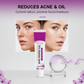 Crema per l'acne con acido azelaico al 12% (20 ml)