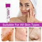 Crema per l'acne con acido azelaico al 12% (20 ml)